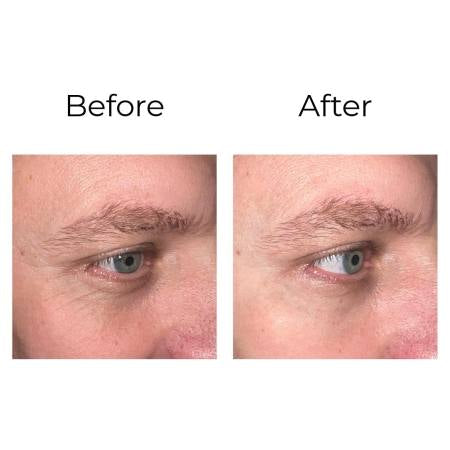 PEPTILUX - Crème pour les yeux à effet « Shock Action » avec LIPHASYN™ Product vendor