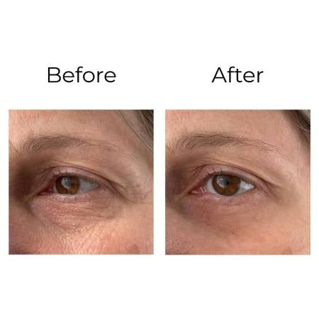 PEPTILUX - Crème pour les yeux à effet « Shock Action » avec LIPHASYN™ Product vendor