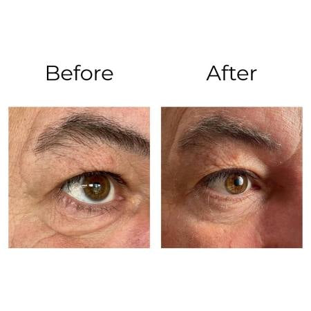 PEPTILUX - Crème pour les yeux à effet « Shock Action » avec LIPHASYN™ Product vendor